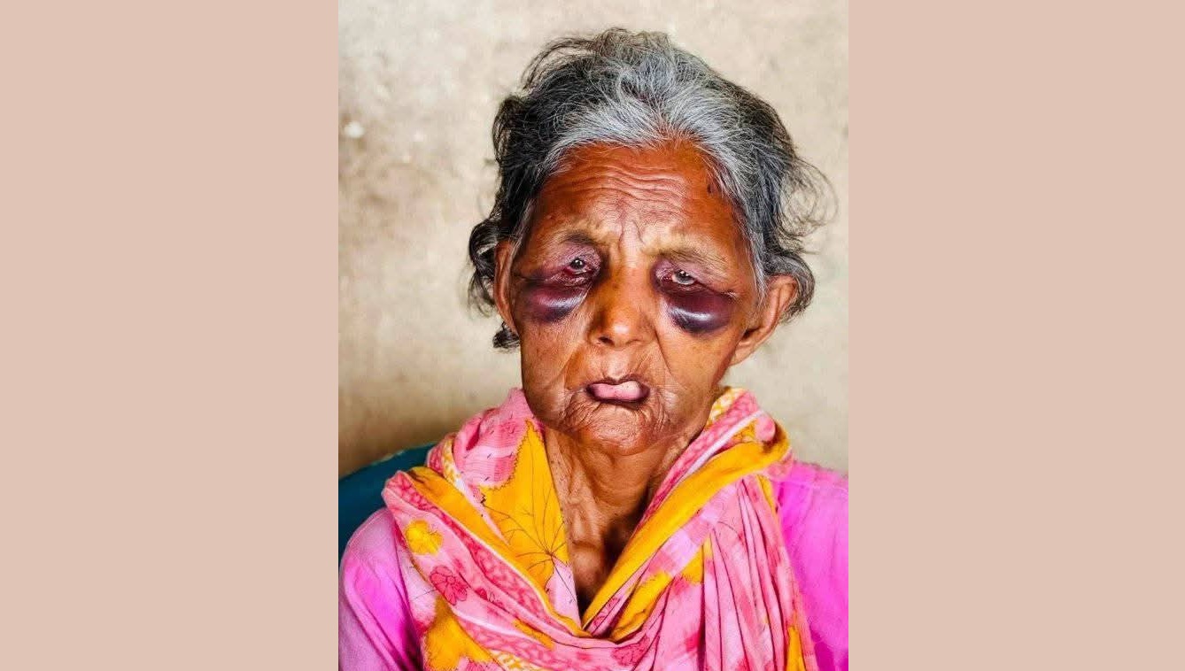 হামলা-লুটের শিকার বাক্‌প্রতিবন্ধী বৃদ্ধা বুবি আর নেই